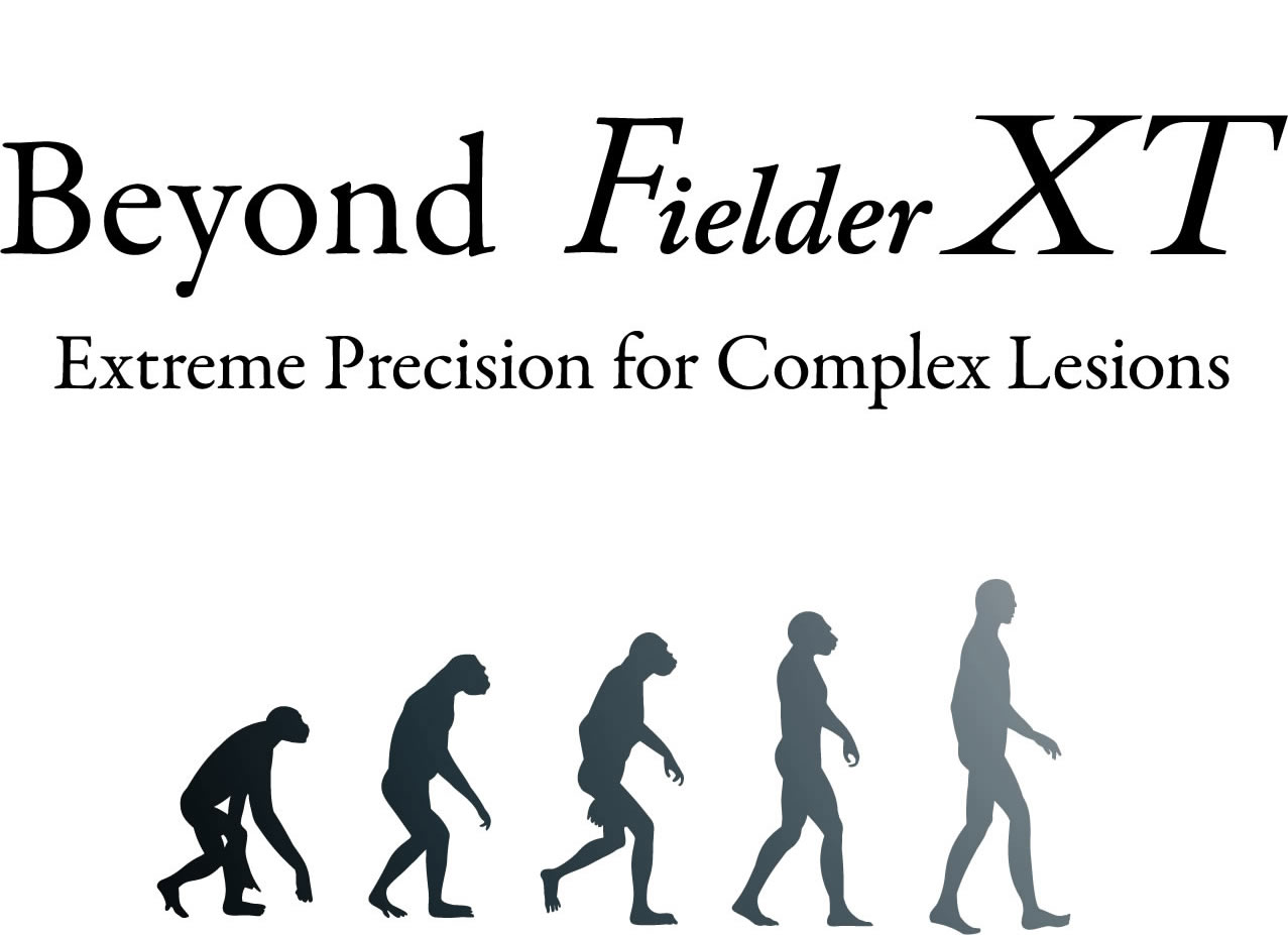 Beyond Fielder XT