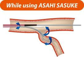 While using ASAHI SASUKE