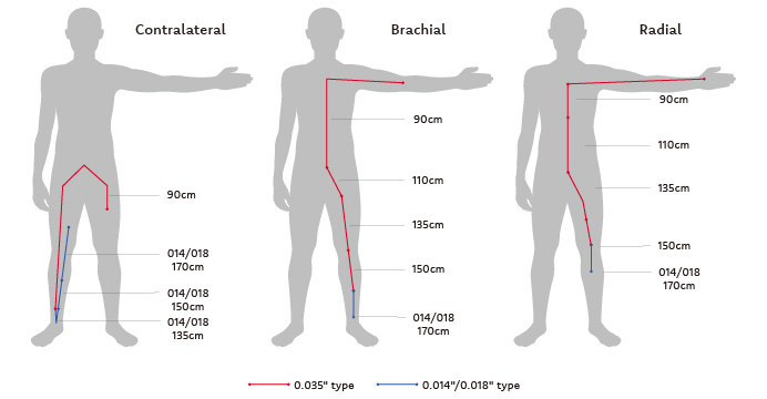 Contralateral / Brachial / Radial