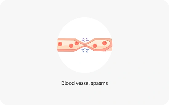 Blood vessel spasms